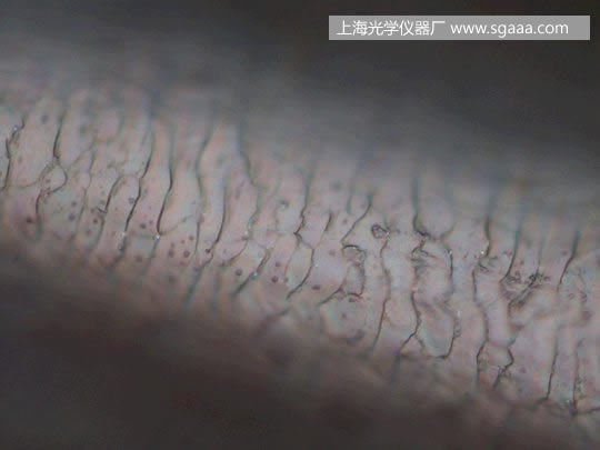 �@΢�R�¿����C��Ⱦ��p�����^�l(f��)